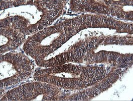 PIK3C2B Antibody (clone OTI3B1)