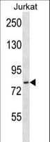 Polyclonal Rabbit anti-Human HJURP Antibody (aa559-588, IHC, WB)