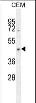 CCDC122 Antibody (aa203-231)