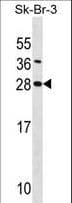 SDC4 / Syndecan 4 Antibody (aa98-127)