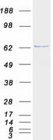 Human ARFGAP3 Protein (Recombinant Myc-DDK (Flag))