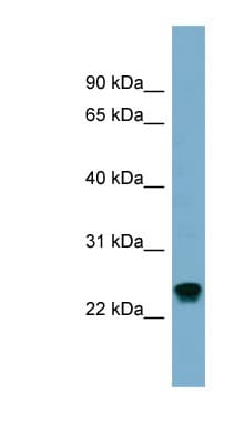 RAB22A / RAB22 Antibody (C-Terminus)