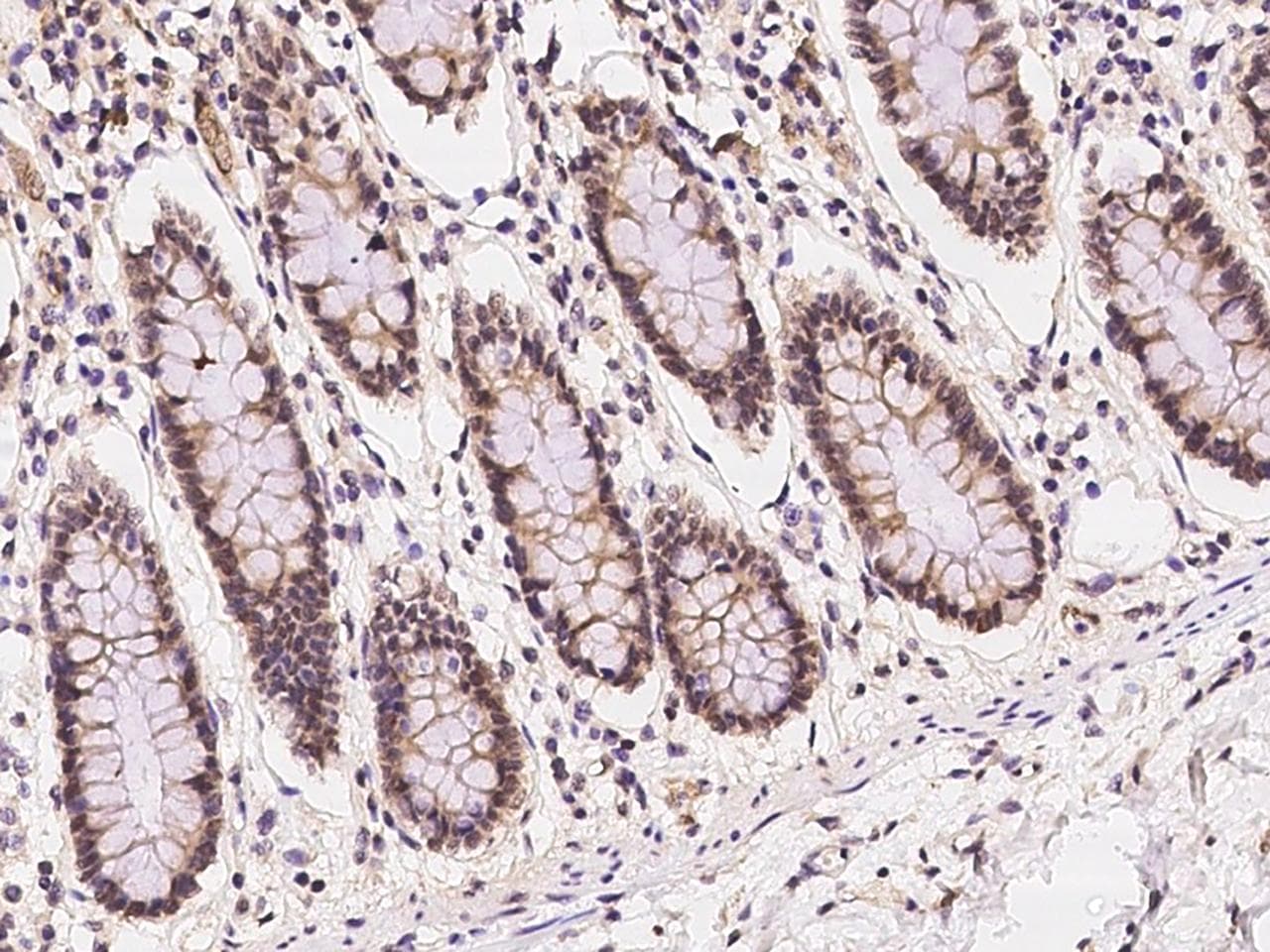 NUB1 Antibody