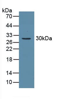 CA2 / Carbonic Anhydrase II Antibody