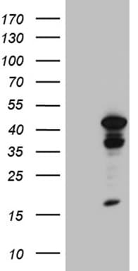 TINF2 Antibody (aa266-347, clone OTI2C12)