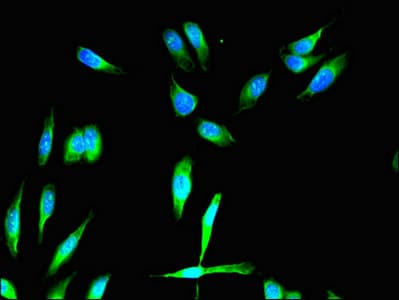 FGFR1 / FGF Receptor 1 Antibody