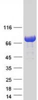 Human TBC1D25 Protein (Recombinant Myc-DDK (Flag))