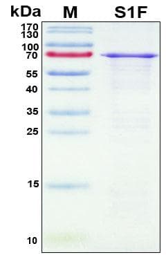 Coronavirus SARS-CoV-2 SARS-CoV-2 S1 Protein (Recombinant His, N-Terminal)