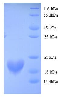 Human RBM3 Protein (Recombinant His)