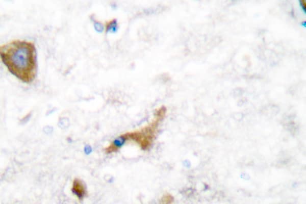 Polyclonal Rabbit anti-Human MMP16 Antibody (Thr583, IHC, WB)