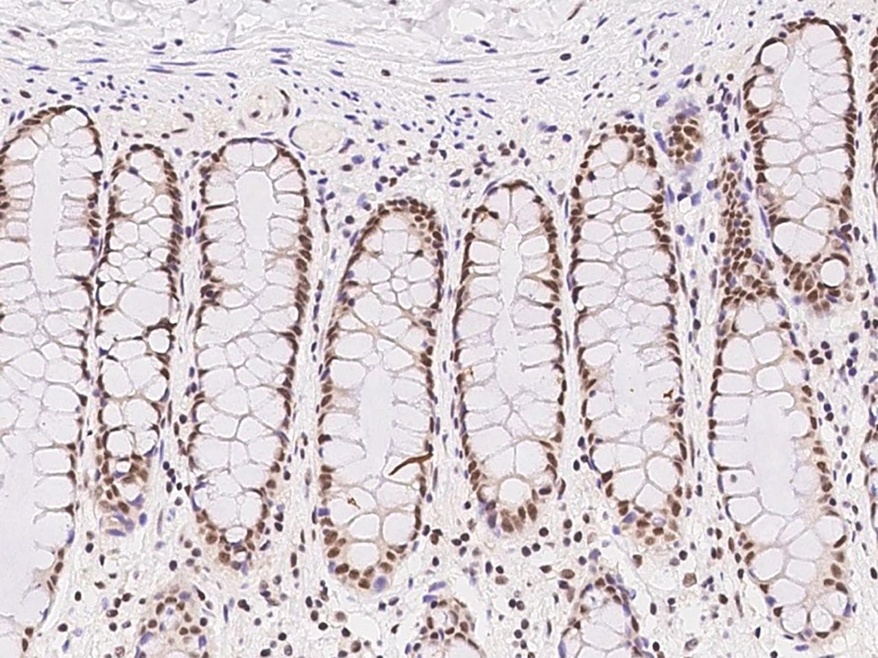 Polyclonal Rabbit anti-Human ZNF146 Antibody (IHC)