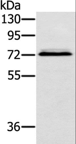 Polyclonal Rabbit anti-Human SSX2IP Antibody (IHC, WB)