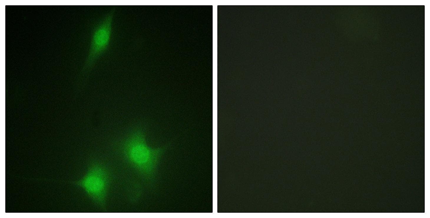 MDM2 Antibody (Ab-186/188)