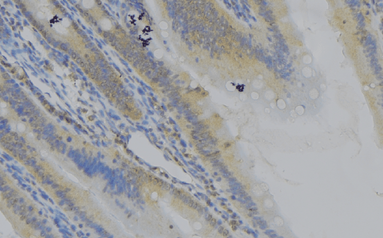 Polyclonal Rabbit anti-Human CLLP / CTNNAL1 Antibody (IHC, WB)
