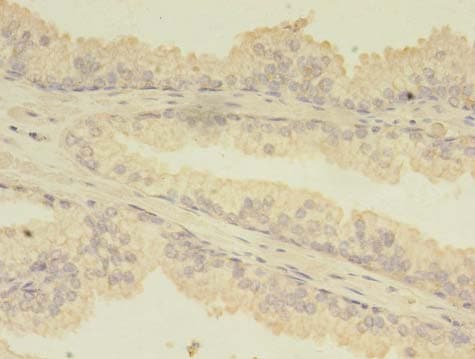 Polyclonal Rabbit anti-Human TBCA Antibody (IHC)