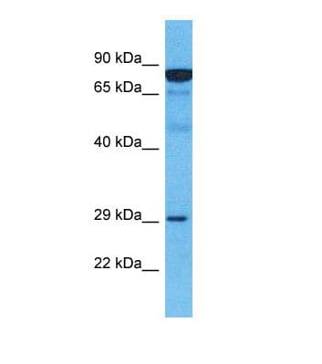 Polyclonal Rabbit anti-Human MARCH2 Antibody (C-Terminus, WB)