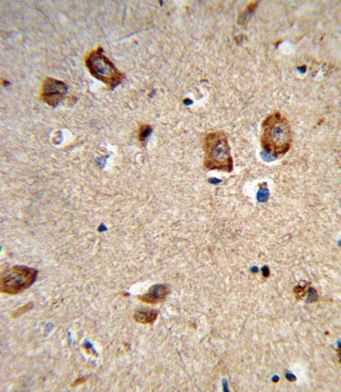 Polyclonal Rabbit anti-Human ITGA1/CD49a/Integrin Alpha 1 Antibody (aa727-755, IHC, WB)