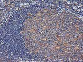 TCL / RHOJ Antibody (clone OTI2C9)