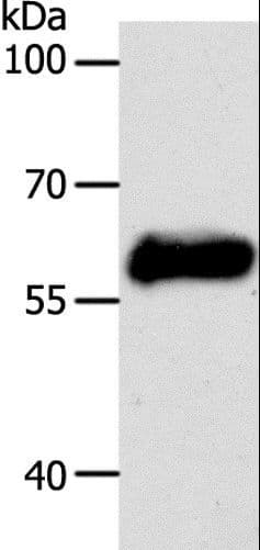 PathPlus™ KRT10 / CK10 / Cytokeratin 10 Antibody