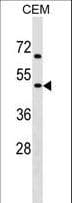 CHRNG Antibody (aa22-50)