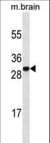 HMG1 / HMGB1 Antibody (aa152-180)