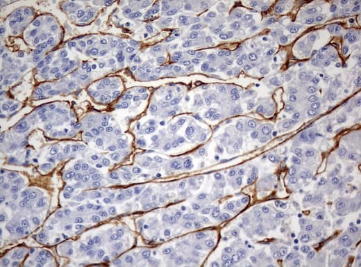 PECAM-1 / CD31 Antibody (clone UMAB32)