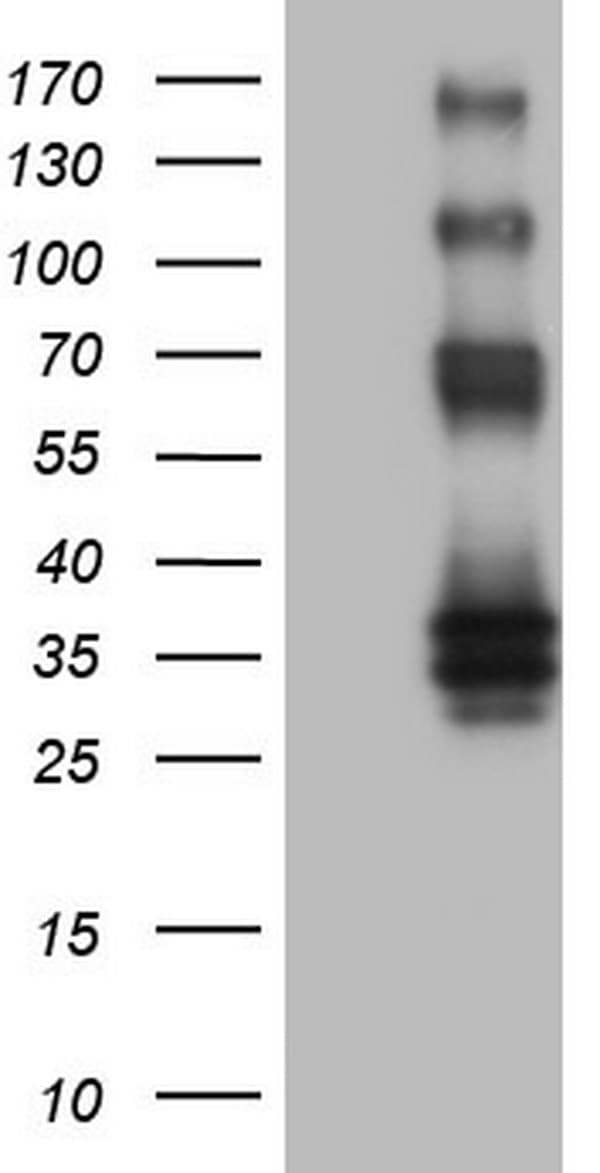 IHC-plus™ Monoclonal Mouse anti-Human PROCR / EPCR Antibody (clone 5E12, aa1-210, IHC, WB)