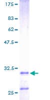 Human Histatin 3 / HTN3 Protein (Recombinant GST)