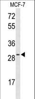 Polyclonal Rabbit anti-Human HES6 Antibody (aa6-34, WB)