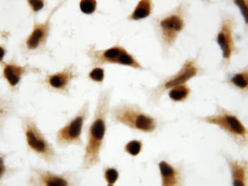 API5 Antibody (aa487-504)