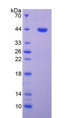 Human CDK2 Protein (Recombinant His-GST)