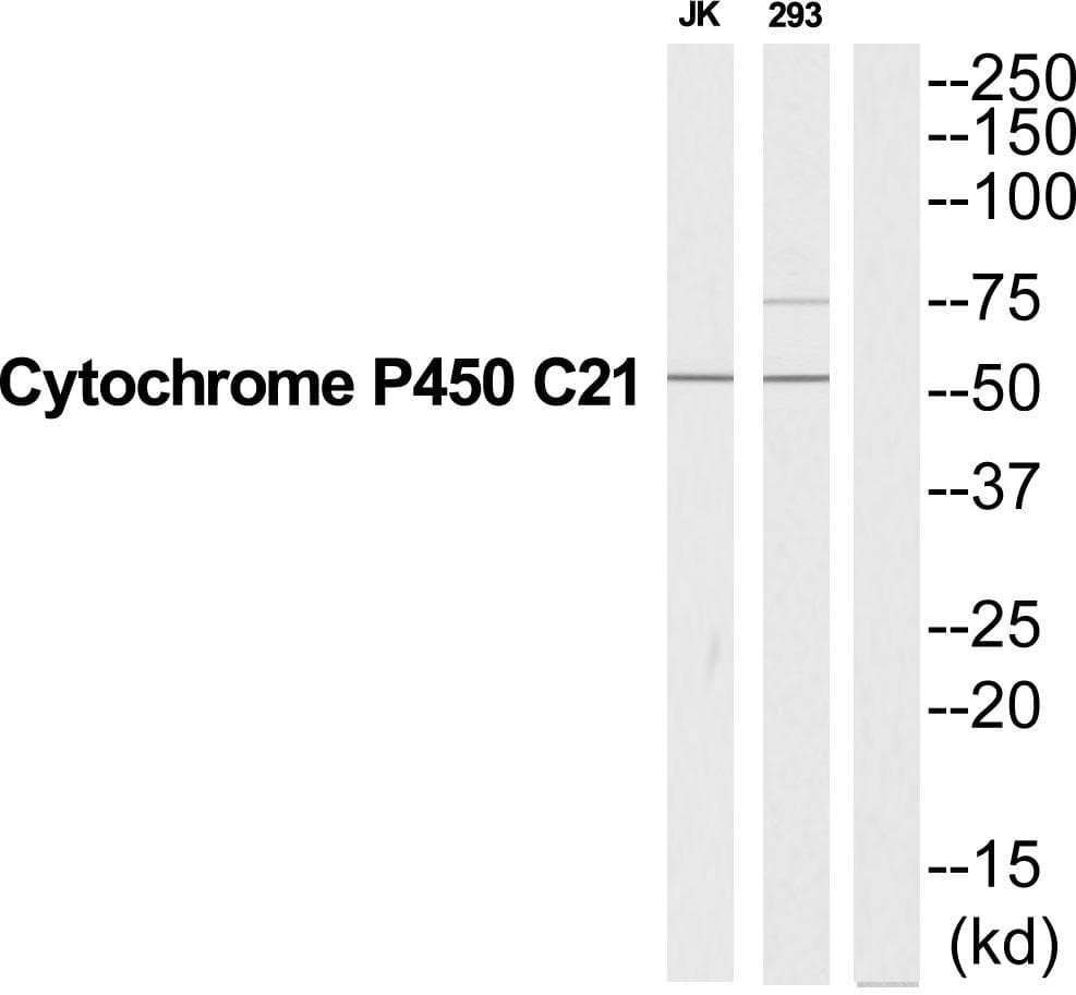 CYP21 / Steroid 21-Hydroxylase Antibody
