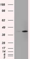 ACAT2 Antibody (clone OTI5A2)