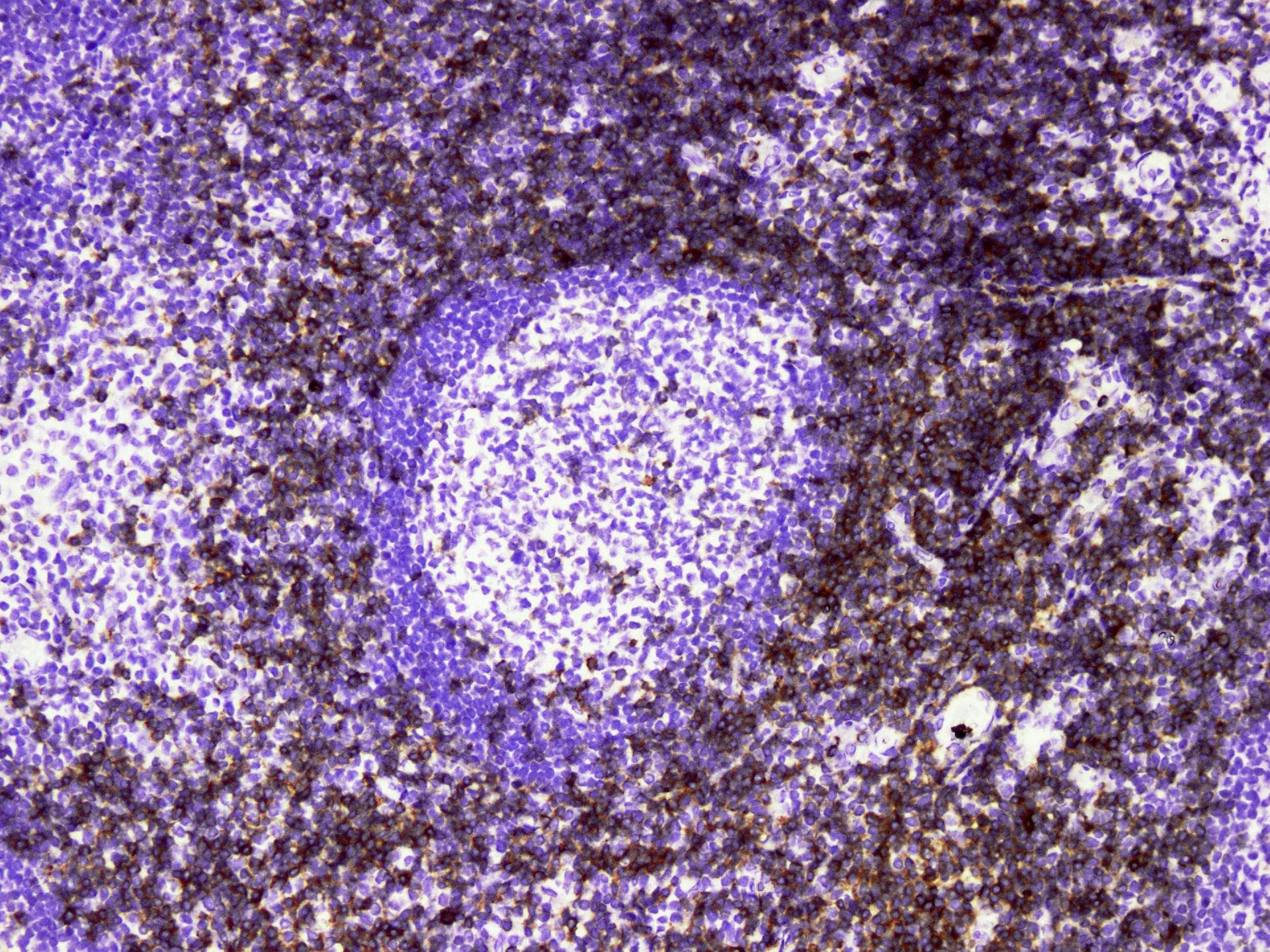 CD7 Antibody