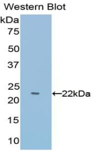 PARK7 / DJ-1 Antibody (aa1-189, PE)