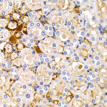 TFF1 / pS2 Antibody