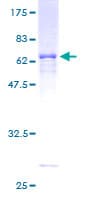 Human AASDHPPT / LYS5 Protein (Recombinant GST)