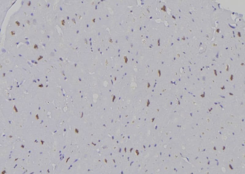 HIST3H3 Antibody (Methyl-Lys9)
