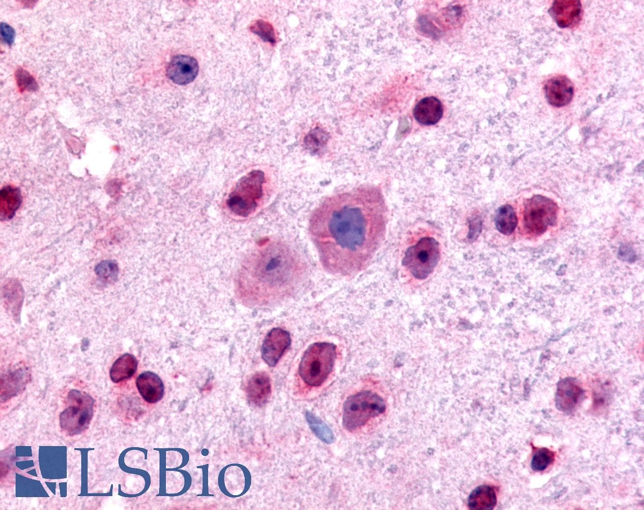 IHC-plus™ GLI2 Antibody (Internal)