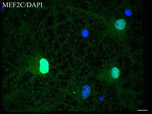 MEF2C Antibody (clone UMAB17)