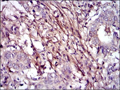 Monoclonal Mouse anti-Human FN1 / Fibronectin Antibody (clone 2F4, IHC, WB)