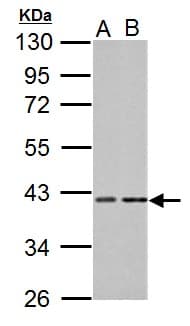 Polyclonal Rabbit anti-Human Proteins, phosphorylated (Pan) Antibody (aa1-351, WB)