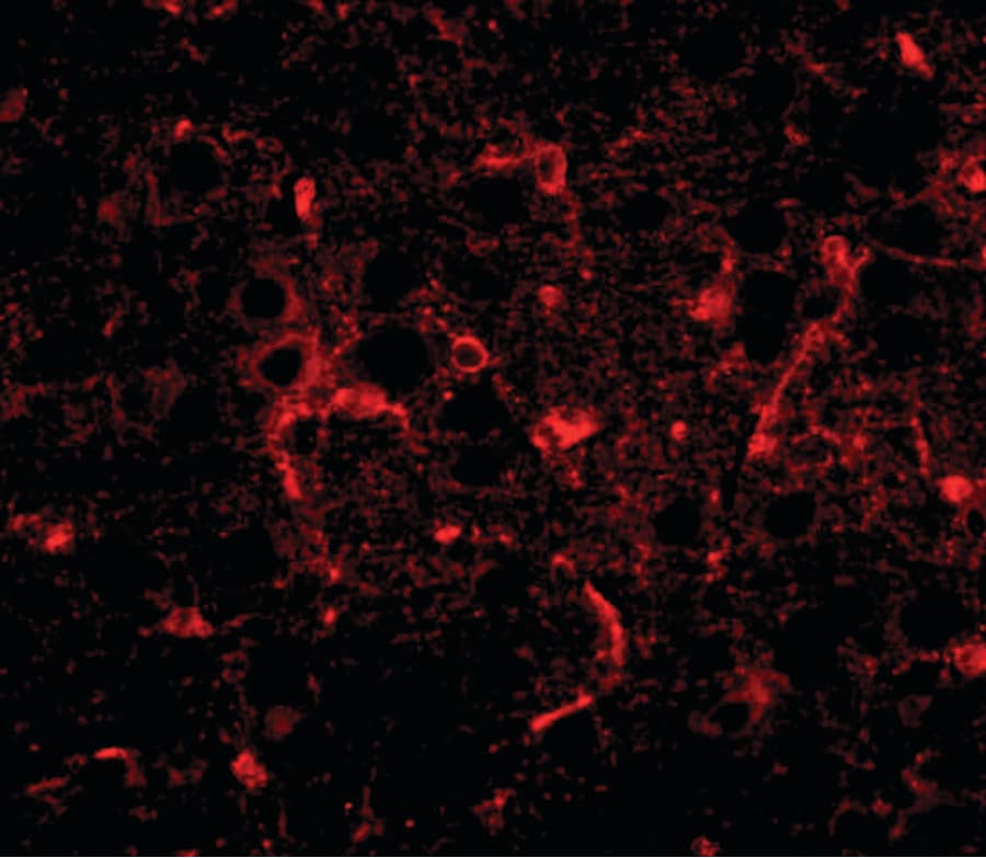 C16orf5 / I1 Antibody