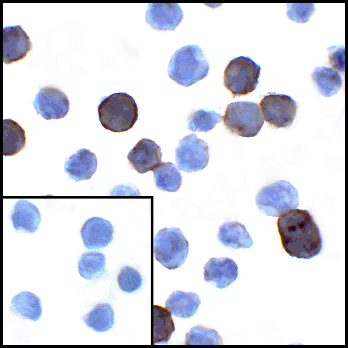 CD274 / B7-H1 / PD-L1 Antibody (clone 8E12)