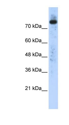 PLD2 / Phospholipase D2 Antibody (N-Terminus)