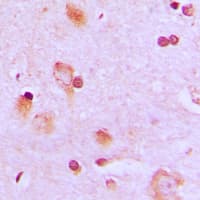 Translokin / CEP57 Antibody (Internal)