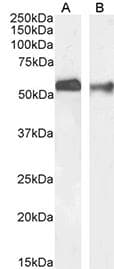 SLC2A1 / GLUT-1 Antibody