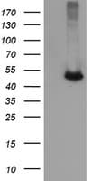 CATIP / C2orf62 Antibody (clone OTI1A6)