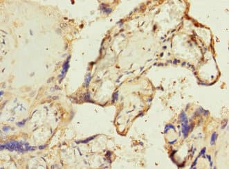 Polyclonal Rabbit anti-Human RPIA / RPI Antibody (IHC, WB)