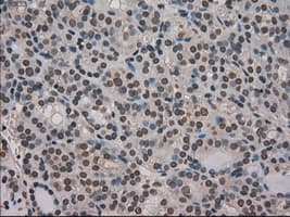Monoclonal Mouse anti-Human MKI67 / Ki67 Antibody (clone OTI3D11, IHC, WB)